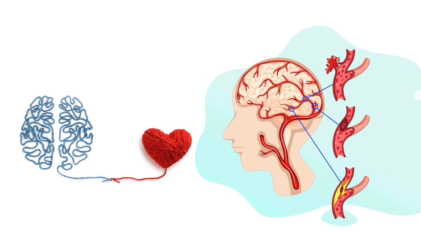 ĐỘT QUỴ VÀ TRIỆU CHỨNG CỦA ĐỘT QUỴ